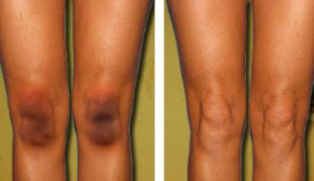 200,000+ Happy CustomersReal Results. Real Women. Real Skin.