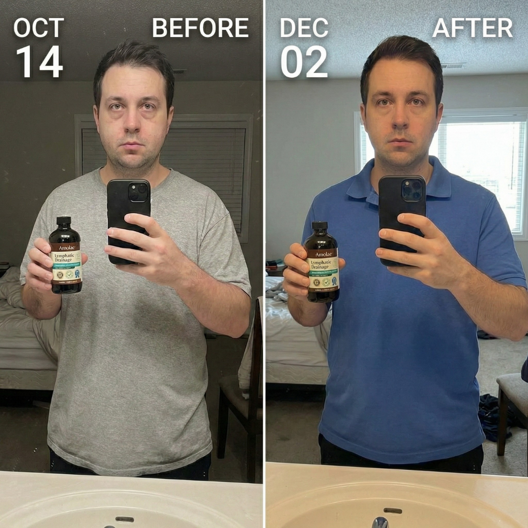 Lymphatic Drainage Drops