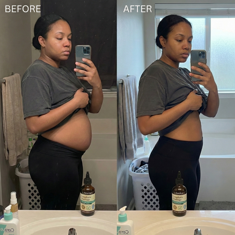 <p><strong>Why Lymphatic Support Matters</strong></p>