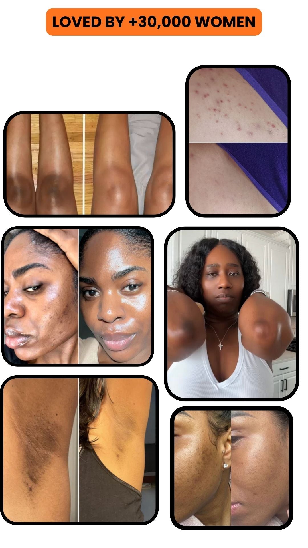 Peel Shot Brightening Spray