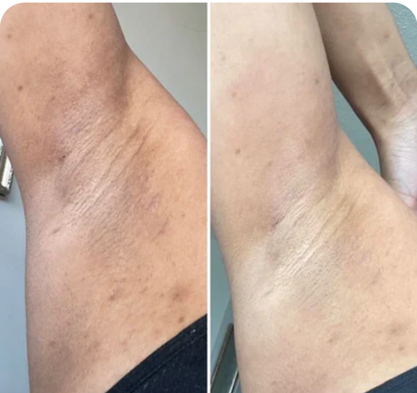 <p><strong>Why Women Are Obsessed</strong></p>