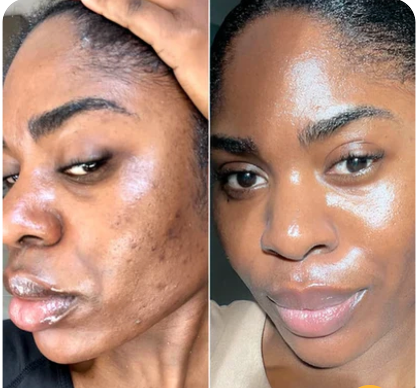 <p><strong>Why Women Are Obsessed</strong></p>