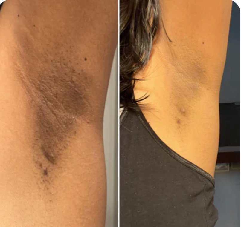 <p><strong>Why Women Are Obsessed</strong></p>