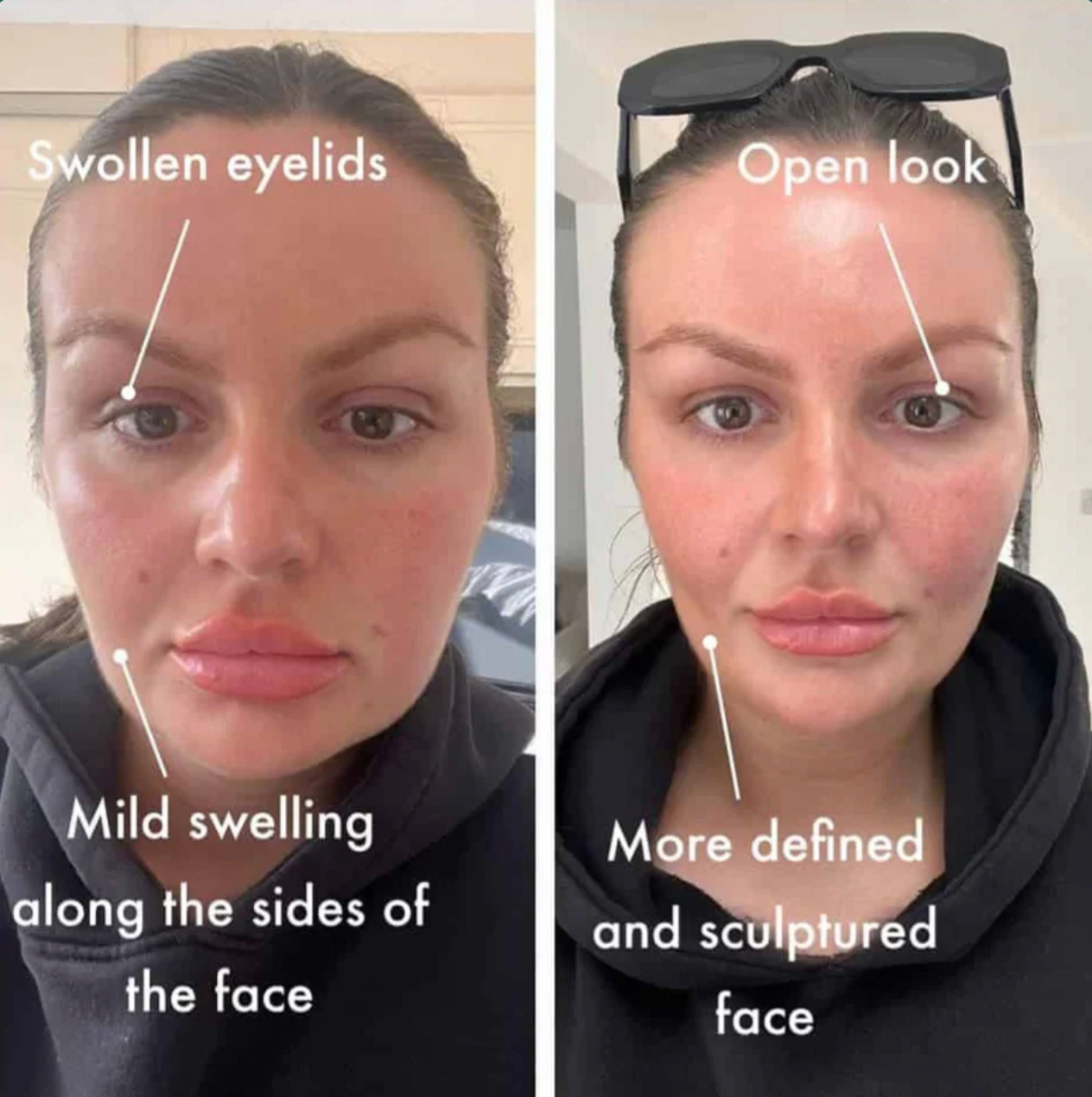 Lymphatic Drainage Drops