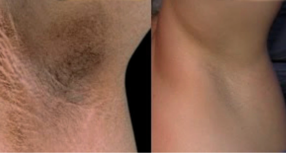 <p><strong>Why Women Are Obsessed</strong></p>