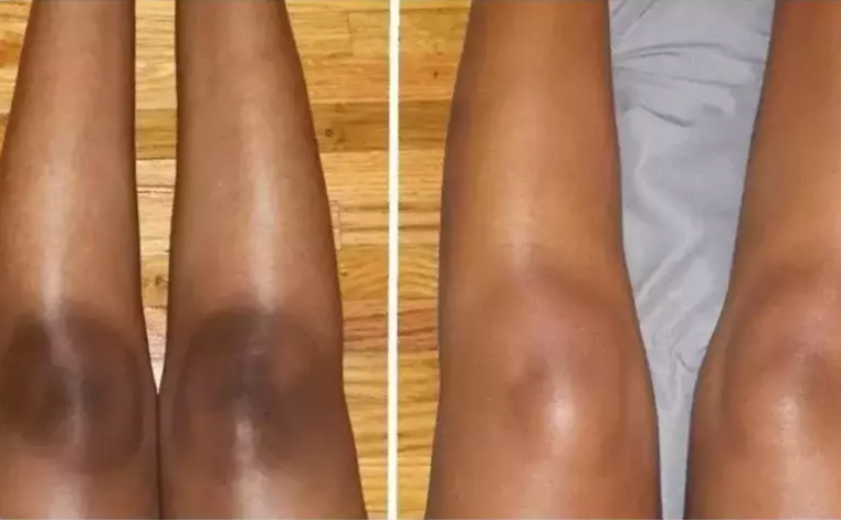 <p><strong>Why Women Are Obsessed</strong></p>