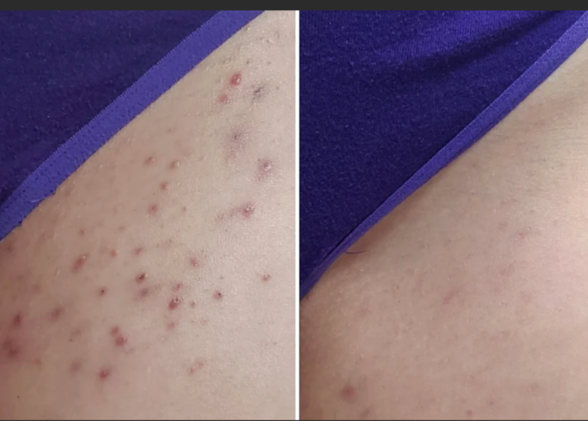 <p><strong>Why Women Are Obsessed</strong></p>