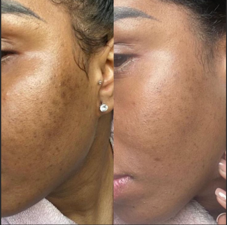 <p><strong>Why Women Are Obsessed</strong></p>