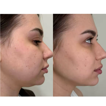 Lymphatic Drainage Drops